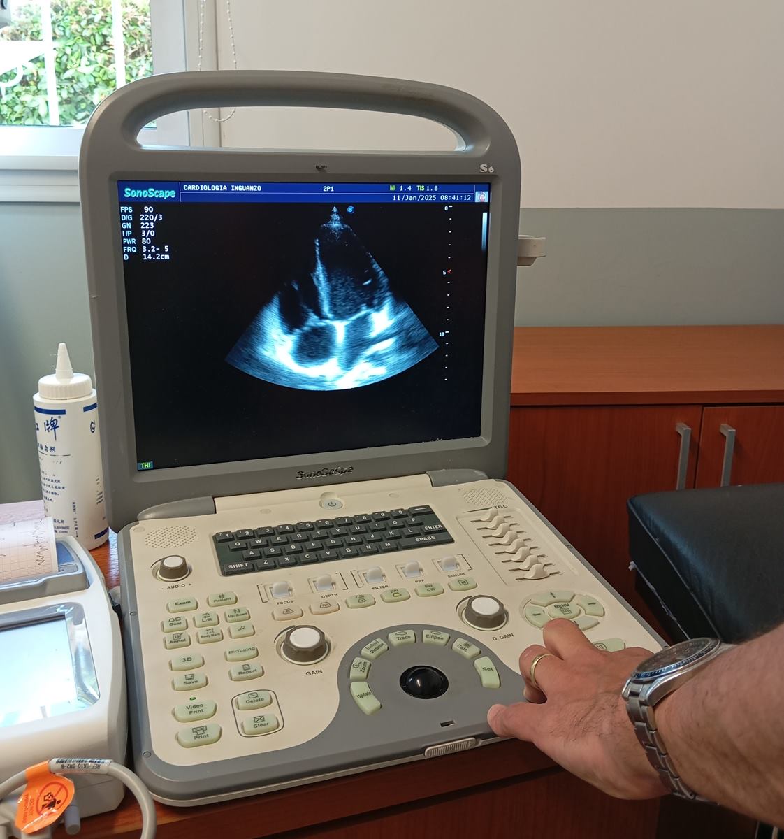 Pantalla del ecógrafo del consultorio mostrando una imagen del corazón