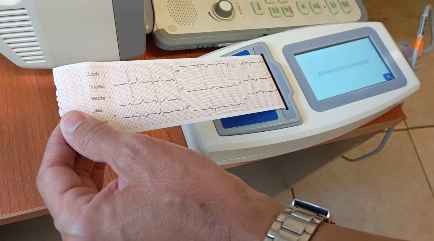 Tira impresa de un electrocardiograma realizado en el consultorio